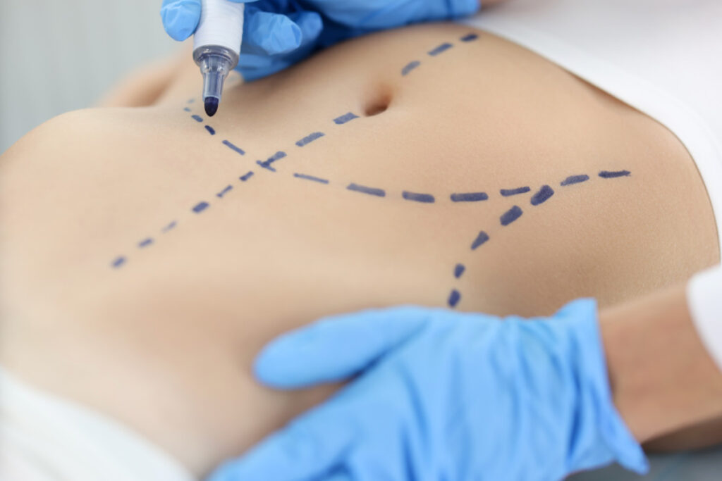 Salud sin Fronteras Blog Cirugía Plástica 1